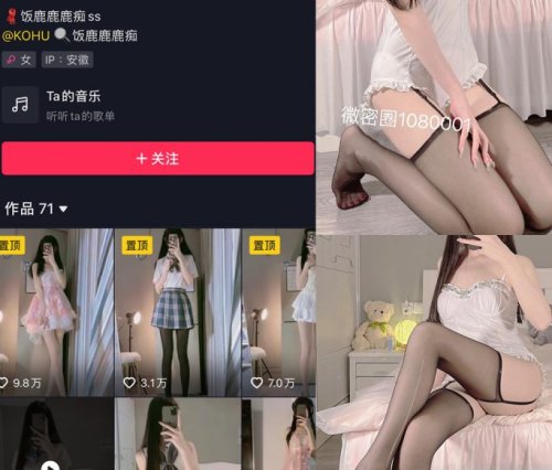 饭鹿鹿鹿痴 – 微密圈合集[16套]9月最新作品